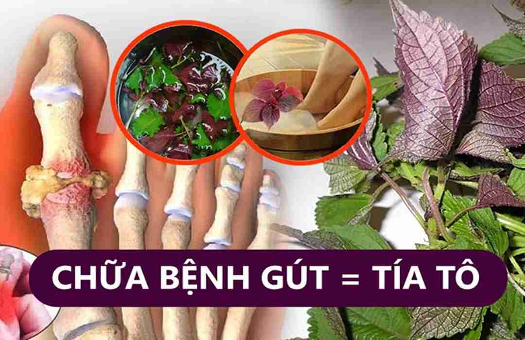 Tía tô có thể giảm bệnh gout hiệu quả